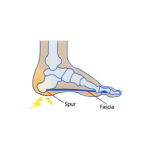 Neat Feat樂活適 足刺紓壓護墊